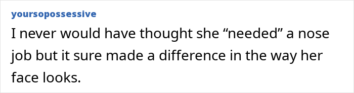 Kaley Cuoco Reveals Moment On ‘Big Bang Theory’ She Realized She’d Gone Too Far With Botox