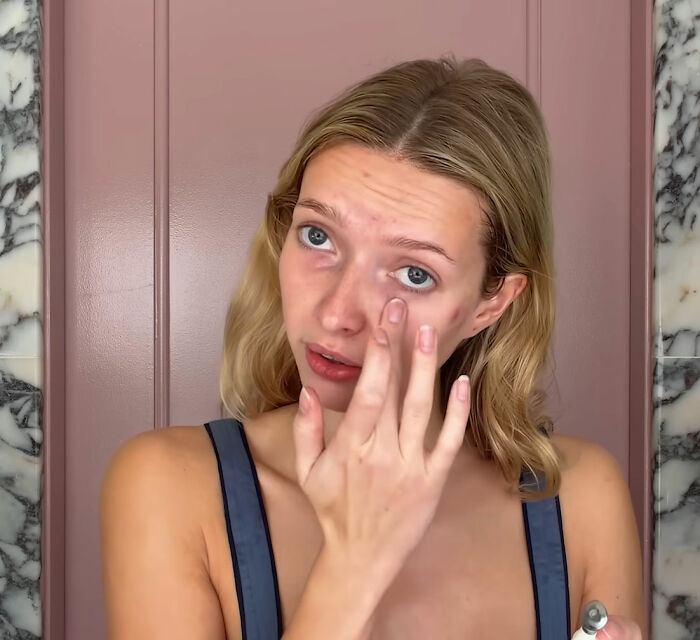 Gwyneth Paltrow’s ‘Nepo Baby’ Apple Martin Reveals All The Cosmetic Procedures She’s Had