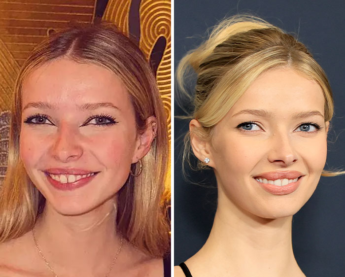 Gwyneth Paltrow’s ‘Nepo Baby’ Apple Martin Reveals All The Cosmetic Procedures She’s Had