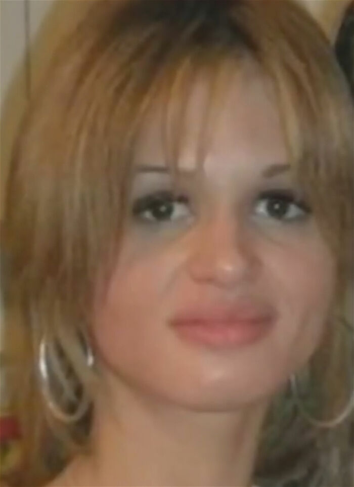 44 Autopsy Findings That Were So Strange, Even Doctors Were Speechless 44 Autopsy Findings That Were So Strange, Even Doctors Were Speechless