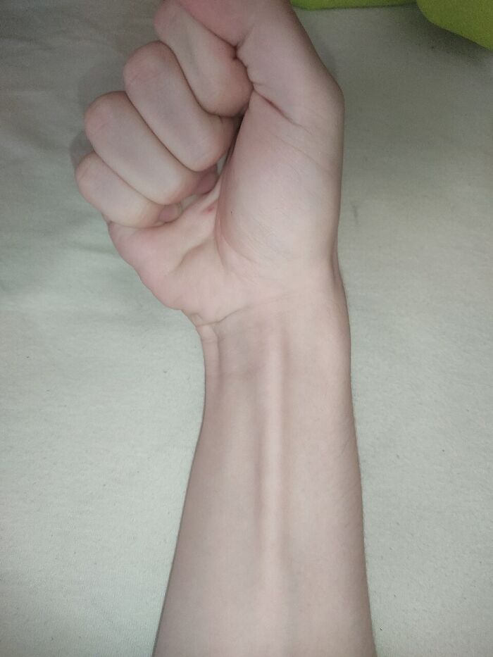 44 Autopsy Findings That Were So Strange, Even Doctors Were Speechless 44 Autopsy Findings That Were So Strange, Even Doctors Were Speechless