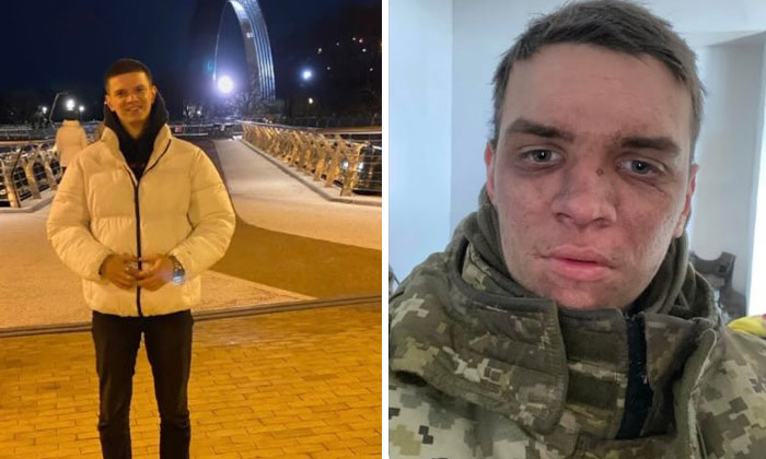 “I Hardly Remember Myself Before The War”: 42 Ukrainian Soldiers Share Powerful Before-And-After Photos “I Hardly Remember Myself Before The War”: 42 Ukrainian Soldiers Share Powerful Before-And-After Photos