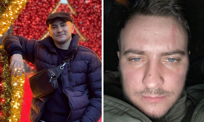 “I Hardly Remember Myself Before The War”: 42 Ukrainian Soldiers Share Powerful Before-And-After Photos “I Hardly Remember Myself Before The War”: 42 Ukrainian Soldiers Share Powerful Before-And-After Photos