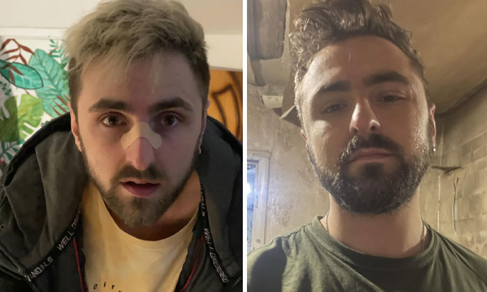 “I Hardly Remember Myself Before The War”: 42 Ukrainian Soldiers Share Powerful Before-And-After Photos “I Hardly Remember Myself Before The War”: 42 Ukrainian Soldiers Share Powerful Before-And-After Photos