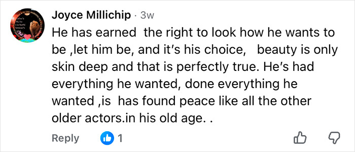 How Mickey Rourke Would Look Today Without His Dramatic Cosmetic Procedures