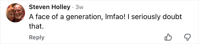 How Mickey Rourke Would Look Today Without His Dramatic Cosmetic Procedures