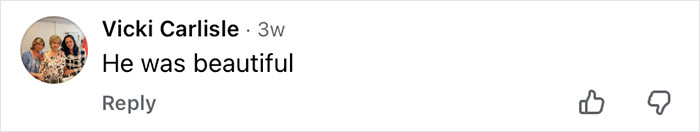 How Mickey Rourke Would Look Today Without His Dramatic Cosmetic Procedures