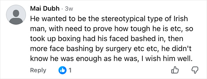 How Mickey Rourke Would Look Today Without His Dramatic Cosmetic Procedures