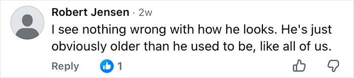 How Mickey Rourke Would Look Today Without His Dramatic Cosmetic Procedures