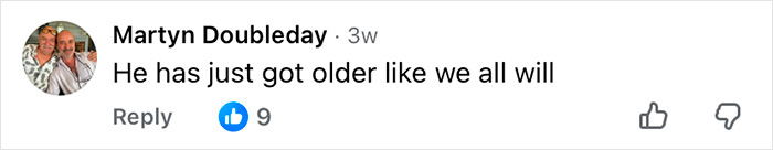 How Mickey Rourke Would Look Today Without His Dramatic Cosmetic Procedures