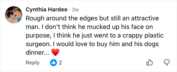 How Mickey Rourke Would Look Today Without His Dramatic Cosmetic Procedures