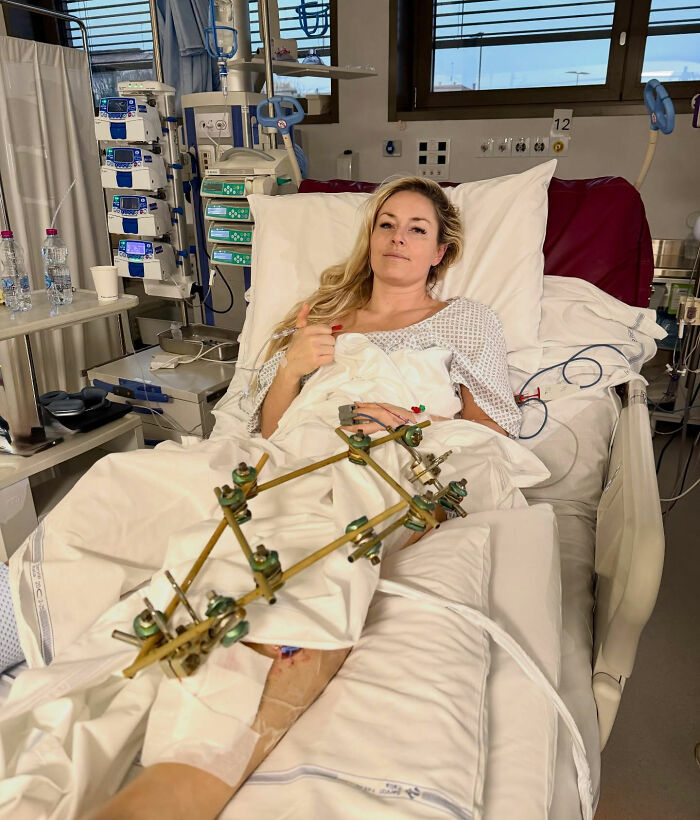 Major Update On Olympian Lindsey Vonn After Horrific Crash That May Cost Her A Leg