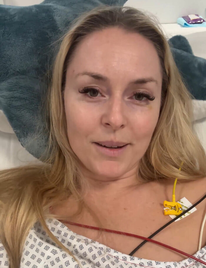 Major Update On Olympian Lindsey Vonn After Horrific Crash That May Cost Her A Leg