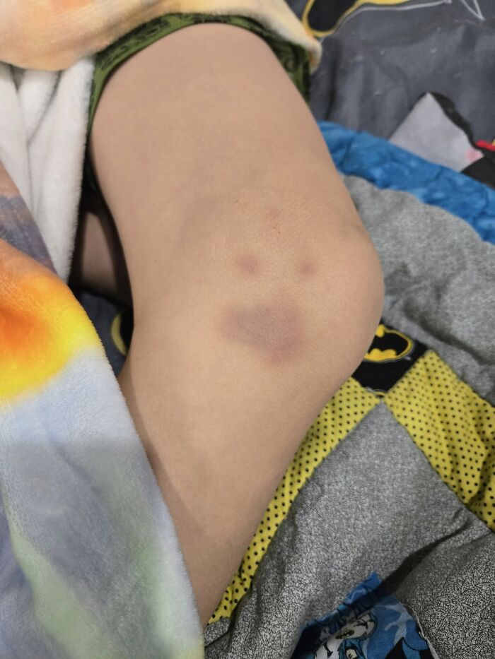 90 Times People Spotted A Face In An Everyday Thing And Just Had To Share (New Pics) 90 Times People Spotted A Face In An Everyday Thing And Just Had To Share (New Pics)