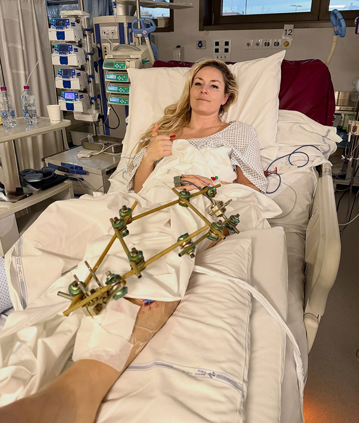Backlash Grows After Major Update In Lindsey Vonn’s Life Following Horrific Olympics Accident Backlash Grows After Major Update In Lindsey Vonn’s Life Following Horrific Olympics Accident