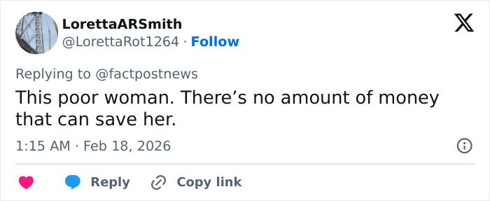 “Doctors Did A Great Job”: Ivanka Trump’s Transformation Scrutinized After Lunar New Year’s Post