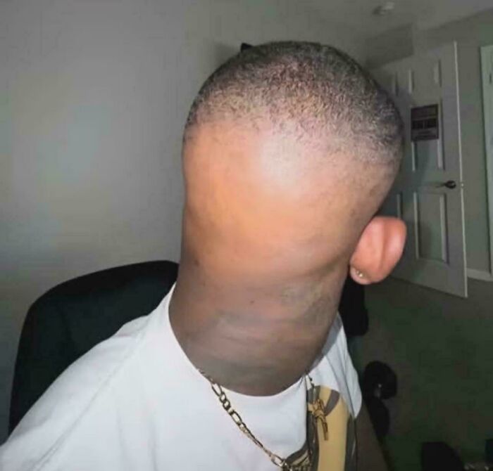 78 Tragic Hair Accidents That Might Make You Rethink Trusting A Hairstylist (New Pics) 78 Tragic Hair Accidents That Might Make You Rethink Trusting A Hairstylist (New Pics)