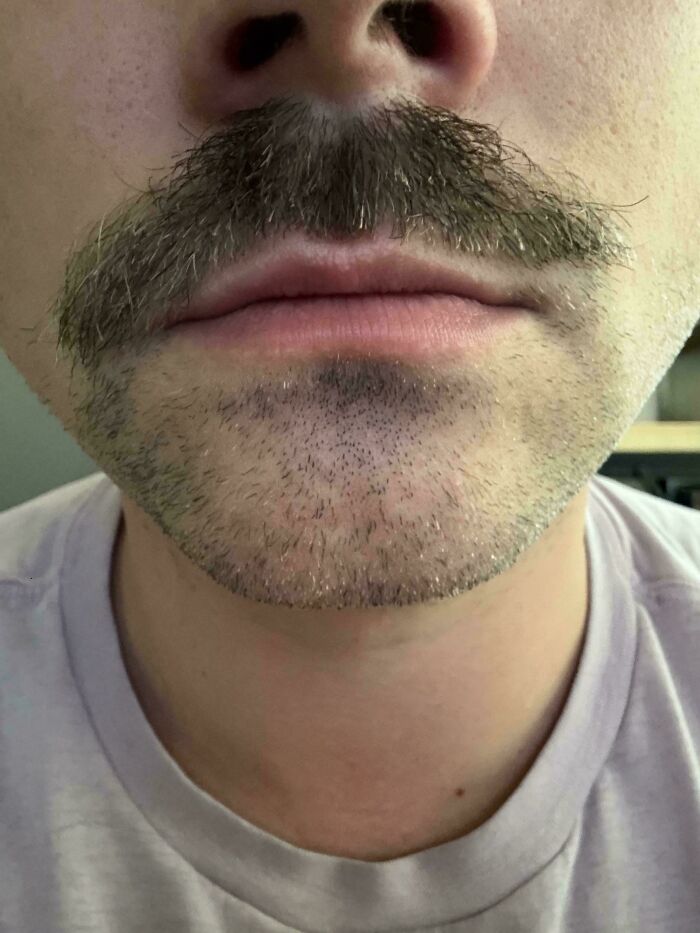 78 Tragic Hair Accidents That Might Make You Rethink Trusting A Hairstylist (New Pics) 78 Tragic Hair Accidents That Might Make You Rethink Trusting A Hairstylist (New Pics)