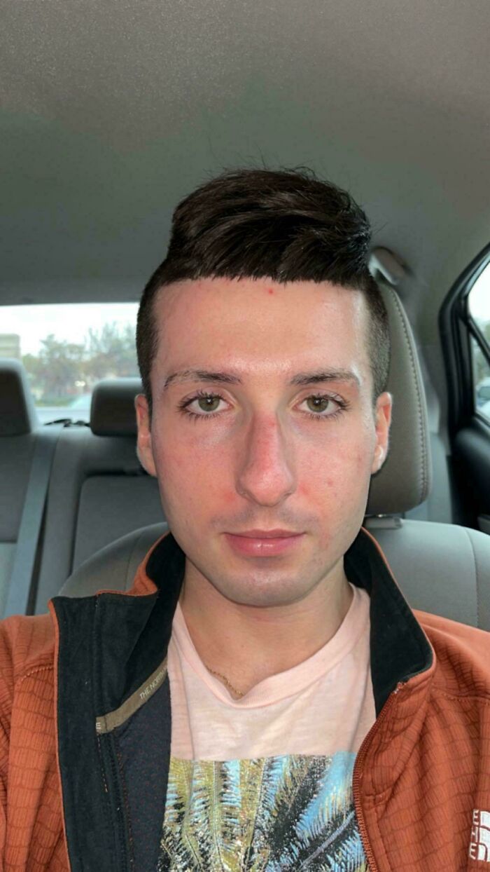 78 Tragic Hair Accidents That Might Make You Rethink Trusting A Hairstylist (New Pics) 78 Tragic Hair Accidents That Might Make You Rethink Trusting A Hairstylist (New Pics)