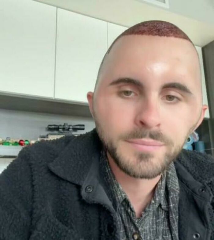 78 Tragic Hair Accidents That Might Make You Rethink Trusting A Hairstylist (New Pics) 78 Tragic Hair Accidents That Might Make You Rethink Trusting A Hairstylist (New Pics)