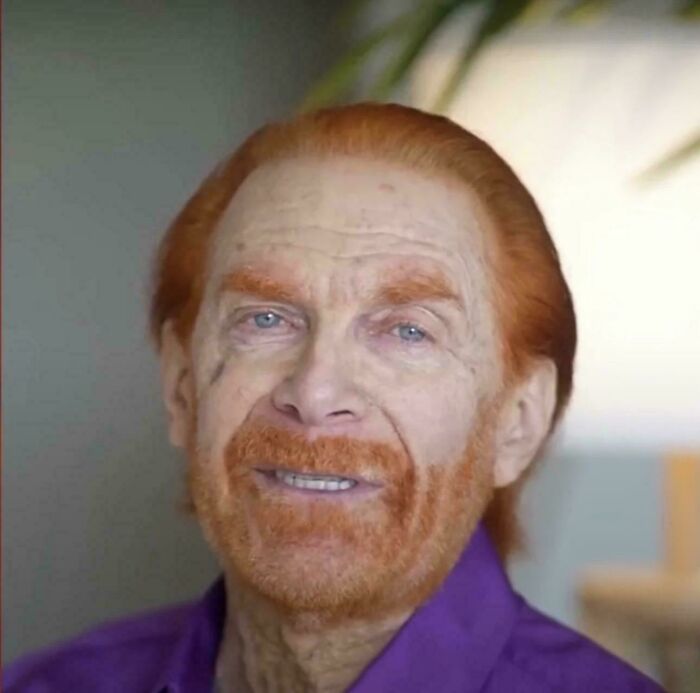 78 Tragic Hair Accidents That Might Make You Rethink Trusting A Hairstylist (New Pics) 78 Tragic Hair Accidents That Might Make You Rethink Trusting A Hairstylist (New Pics)