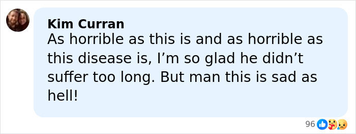 Doctors Break Down Commonly Ignored ALS Symptoms After Eric Dane&rsquo;s Hand Claim