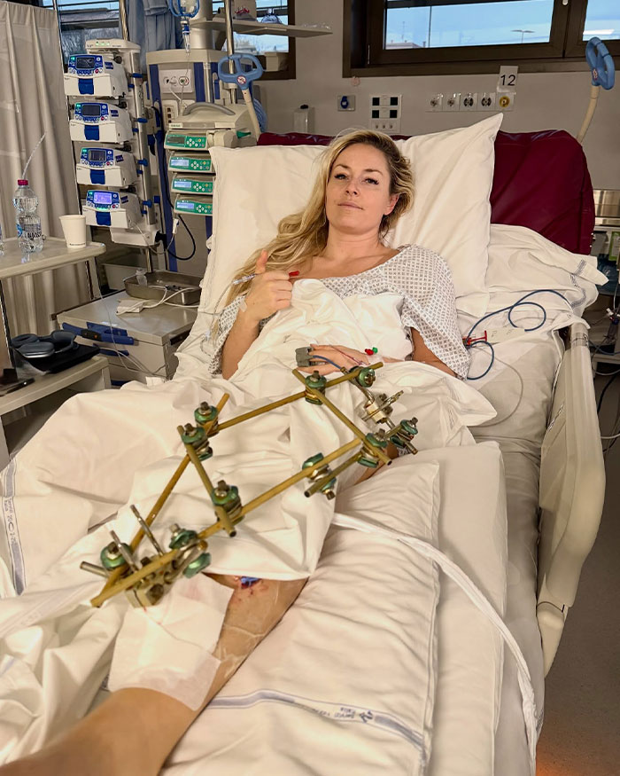 Following Fifth Surgery On Broken Leg, Lindsey Vonn Speaks Out And Makes Heartbreaking Admission