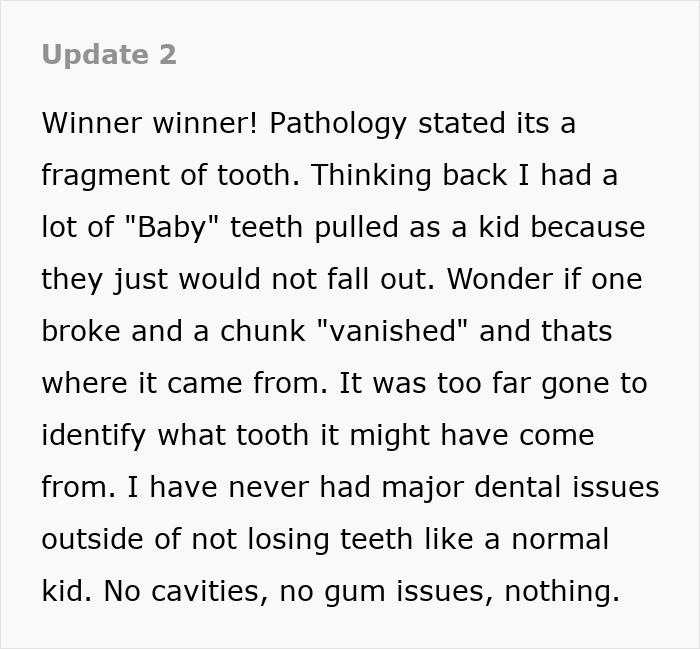 “I Could Barely Eat”: Man Spends 35 Years With Throat Pain, Finally Solves His Own Medical Mystery
