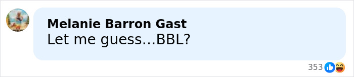 Glamorous Influencer Passes Away At 27 Following Complications From Major Plastic Surgery Glamorous Influencer Passes Away At 27 Following Complications From Major Plastic Surgery