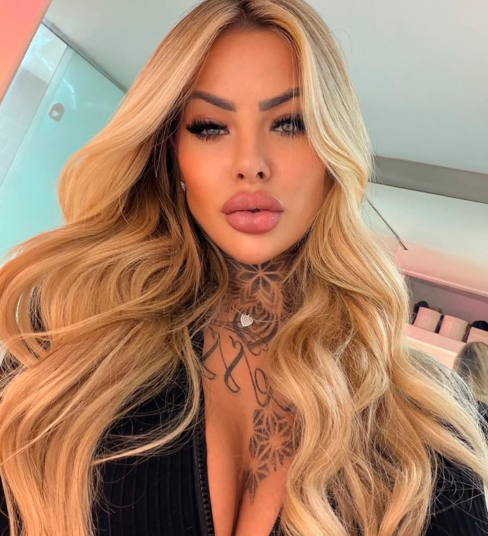 Glamorous Influencer Passes Away At 27 Following Complications From Major Plastic Surgery Glamorous Influencer Passes Away At 27 Following Complications From Major Plastic Surgery