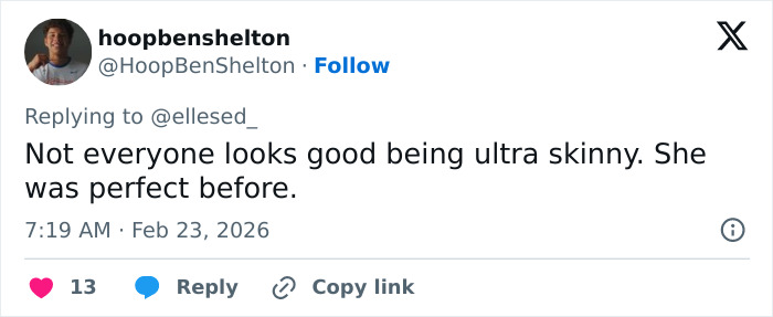 “She Looks Cadaverous”: Emma Stone’s Appearance At The 2026 BAFTAs Sparks Major Concerns