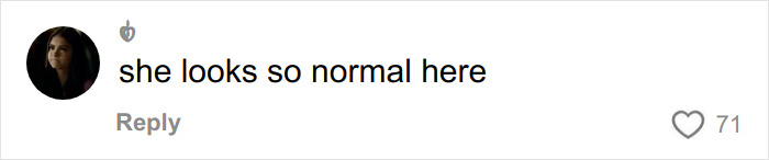 “She Dissolved That Lip?”: Fans Spot Major Detail In Kylie Jenner’s Appearance At The 2026 BAFTAs “She Dissolved That Lip?”: Fans Spot Major Detail In Kylie Jenner’s Appearance At The 2026 BAFTAs