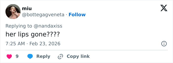 “She Dissolved That Lip?”: Fans Spot Major Detail In Kylie Jenner’s Appearance At The 2026 BAFTAs “She Dissolved That Lip?”: Fans Spot Major Detail In Kylie Jenner’s Appearance At The 2026 BAFTAs