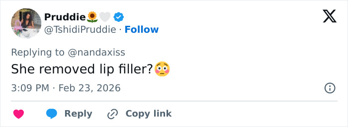 “She Dissolved That Lip?”: Fans Spot Major Detail In Kylie Jenner’s Appearance At The 2026 BAFTAs “She Dissolved That Lip?”: Fans Spot Major Detail In Kylie Jenner’s Appearance At The 2026 BAFTAs