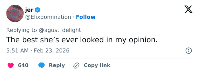 “She Dissolved That Lip?”: Fans Spot Major Detail In Kylie Jenner’s Appearance At The 2026 BAFTAs “She Dissolved That Lip?”: Fans Spot Major Detail In Kylie Jenner’s Appearance At The 2026 BAFTAs