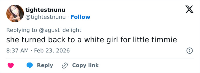 “She Dissolved That Lip?”: Fans Spot Major Detail In Kylie Jenner’s Appearance At The 2026 BAFTAs “She Dissolved That Lip?”: Fans Spot Major Detail In Kylie Jenner’s Appearance At The 2026 BAFTAs