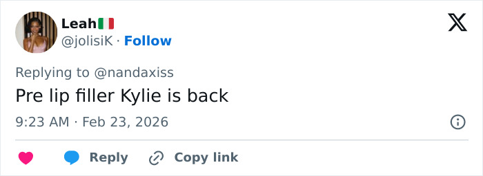 “She Dissolved That Lip?”: Fans Spot Major Detail In Kylie Jenner’s Appearance At The 2026 BAFTAs “She Dissolved That Lip?”: Fans Spot Major Detail In Kylie Jenner’s Appearance At The 2026 BAFTAs