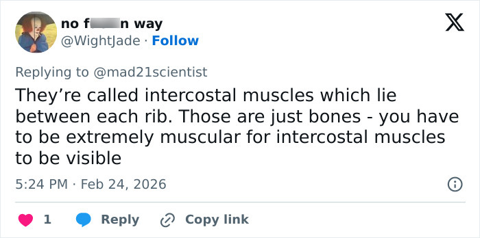 “Those Are Her Ribs”: Sadie Sink’s BAFTA Look Triggers Wave Of Divided Reactions “Those Are Her Ribs”: Sadie Sink’s BAFTA Look Triggers Wave Of Divided Reactions