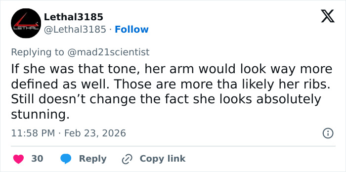 “Those Are Her Ribs”: Sadie Sink’s BAFTA Look Triggers Wave Of Divided Reactions “Those Are Her Ribs”: Sadie Sink’s BAFTA Look Triggers Wave Of Divided Reactions