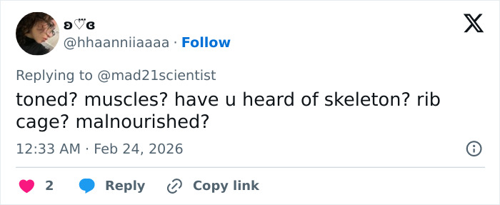 “Those Are Her Ribs”: Sadie Sink’s BAFTA Look Triggers Wave Of Divided Reactions “Those Are Her Ribs”: Sadie Sink’s BAFTA Look Triggers Wave Of Divided Reactions