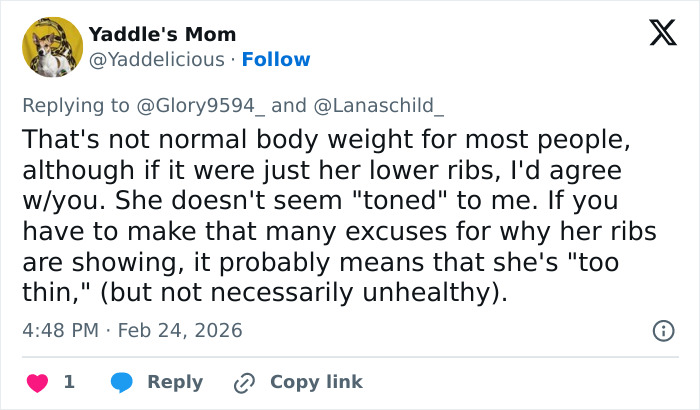 “Those Are Her Ribs”: Sadie Sink’s BAFTA Look Triggers Wave Of Divided Reactions “Those Are Her Ribs”: Sadie Sink’s BAFTA Look Triggers Wave Of Divided Reactions