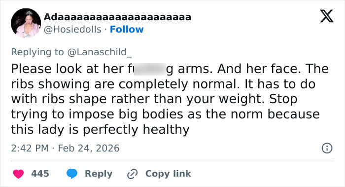 “Those Are Her Ribs”: Sadie Sink’s BAFTA Look Triggers Wave Of Divided Reactions “Those Are Her Ribs”: Sadie Sink’s BAFTA Look Triggers Wave Of Divided Reactions