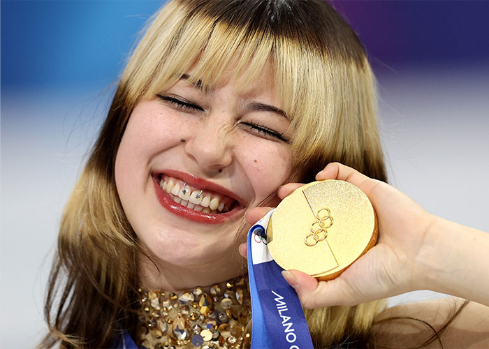 Health Experts Sound Alarm For Fans Eager To Copy Olympic Star Alysa Liu&rsquo;s &lsquo;Viral&rsquo; Look