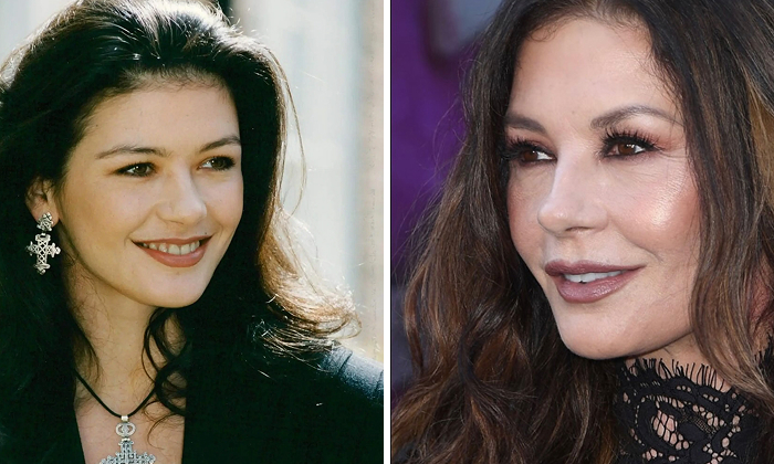 From Gaps To Glam: 12 Celebrity Dental Implant Makeovers You Won’t Believe From Gaps To Glam: 12 Celebrity Dental Implant Makeovers You Won’t Believe