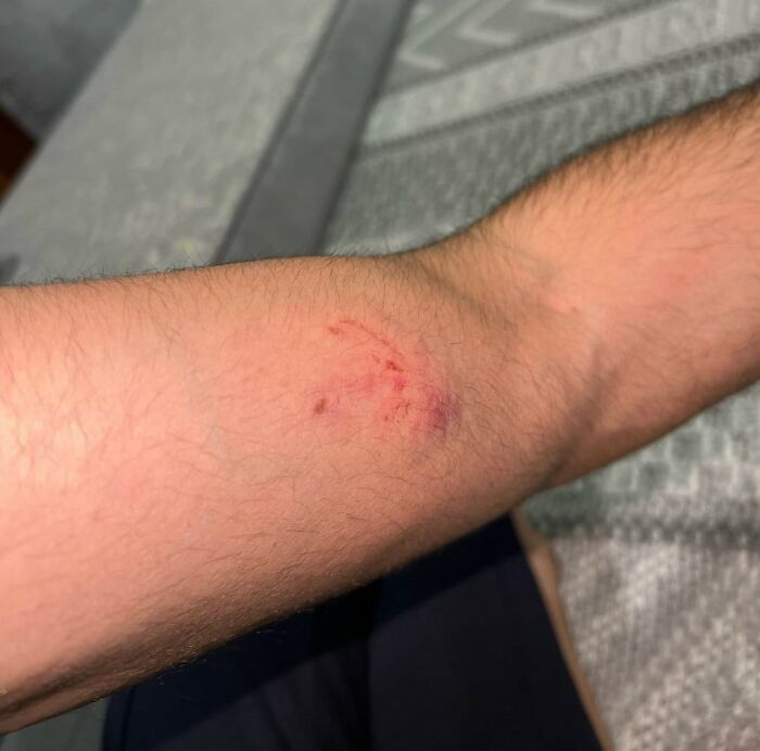 “She Bit Me”: 56 Of The Wildest Dating Experiences That Made People Question Reality “She Bit Me”: 56 Of The Wildest Dating Experiences That Made People Question Reality