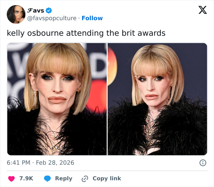Fans Accuse Kelly Osbourne Of Buccal Fat Removal As Her Brit Awards Look Goes Viral