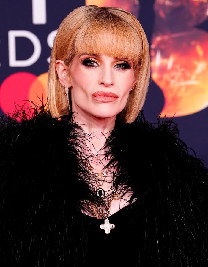 Fans Accuse Kelly Osbourne Of Buccal Fat Removal As Her Brit Awards Look Goes Viral