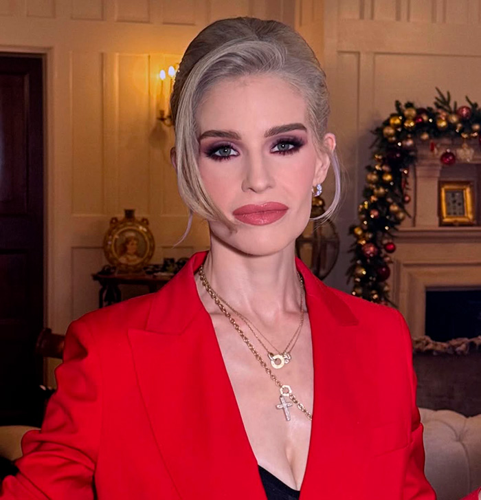 Fans Accuse Kelly Osbourne Of Buccal Fat Removal As Her Brit Awards Look Goes Viral