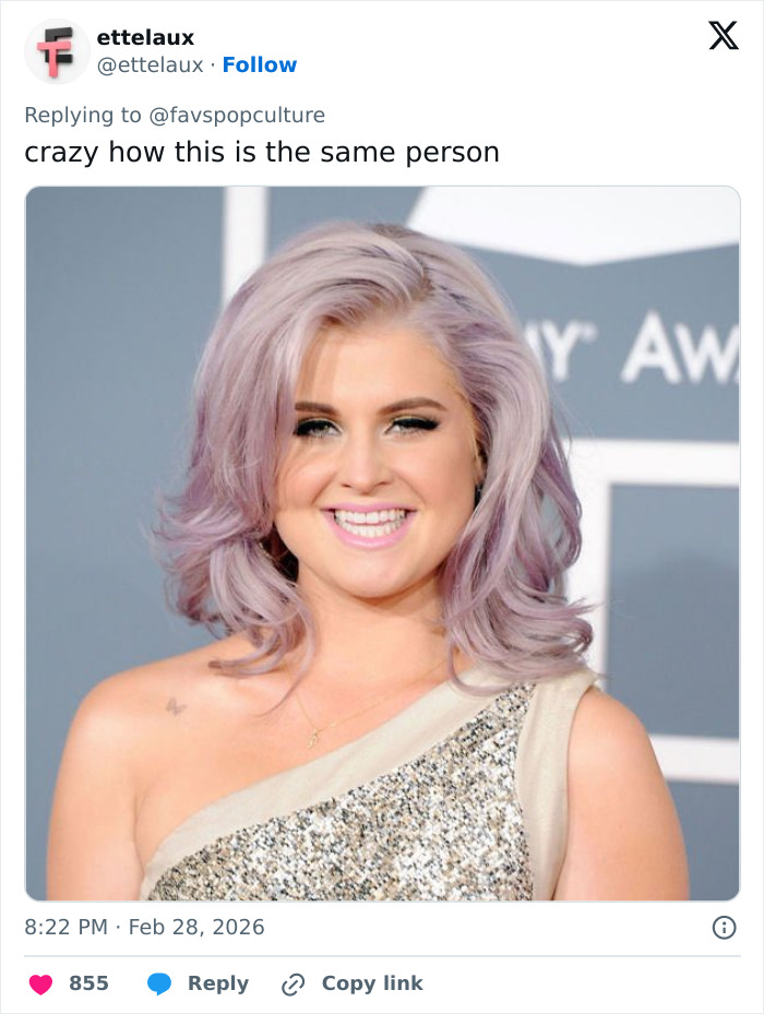 Fans Accuse Kelly Osbourne Of Buccal Fat Removal As Her Brit Awards Look Goes Viral
