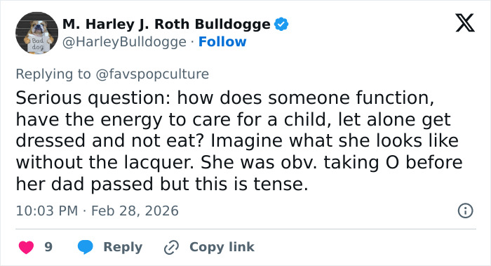 Fans Accuse Kelly Osbourne Of Buccal Fat Removal As Her Brit Awards Look Goes Viral